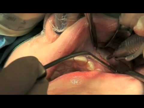 chirurgia ortognatica