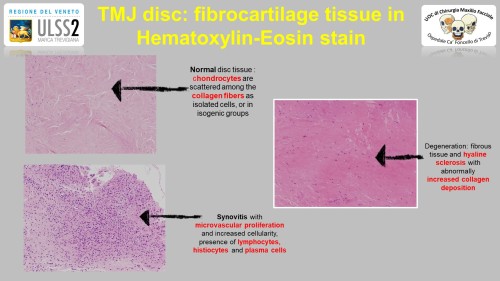 TMJ disc fibrocartilage tissue in Hematoxylin-Eosin stain